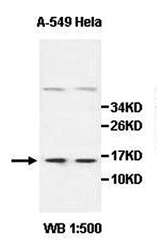 CDKN2B Rabbit Polyclonal Antibody