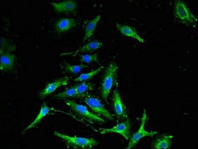 CDKN2C antibody