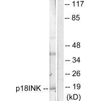 CDKN2C antibody