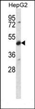 CDR2 antibody