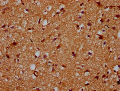 CDS2 Antibody
