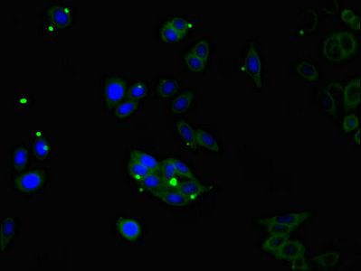 CDSN Antibody