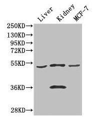 CDSN antibody