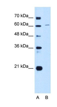 CDT1 antibody