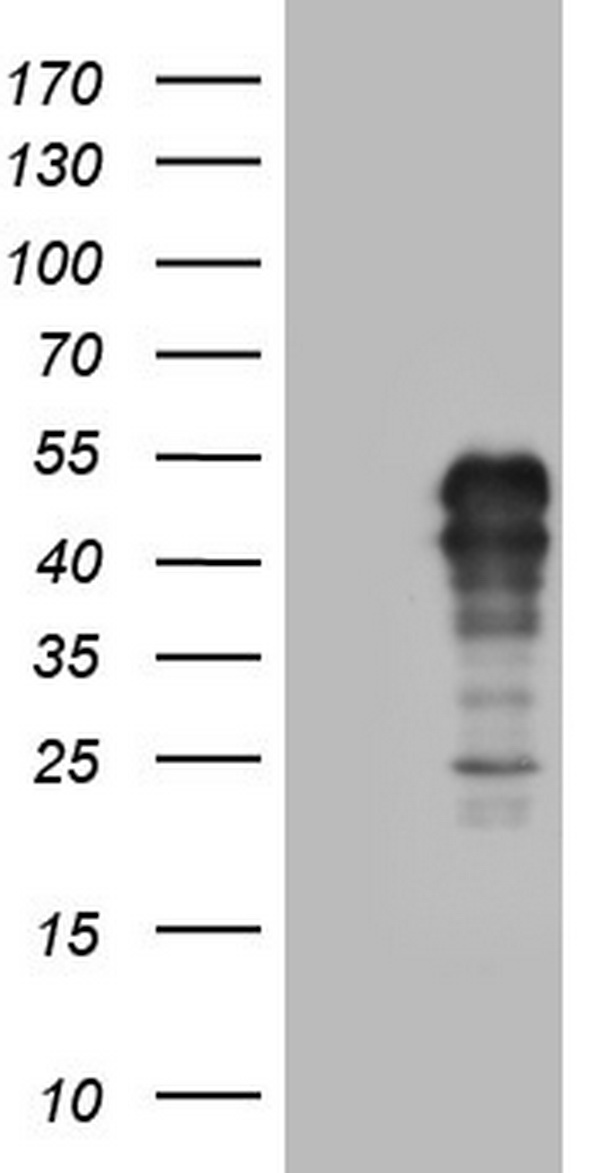 CDX2 Antibody
