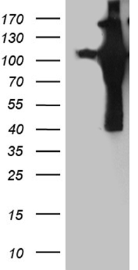 CDY2B Antibody