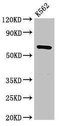 CDYL antibody