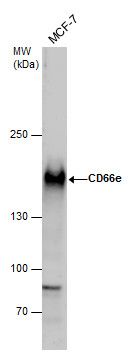 CEA antibody