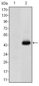 CEA Antibody