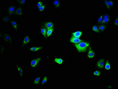 CEACAM1 antibody