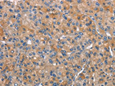 CEACAM1 Antibody