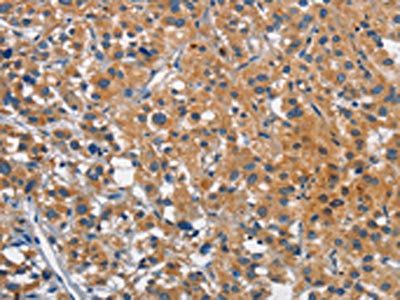 CEACAM1 Antibody