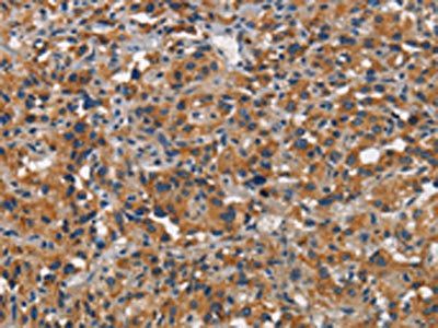 CEACAM1 Antibody