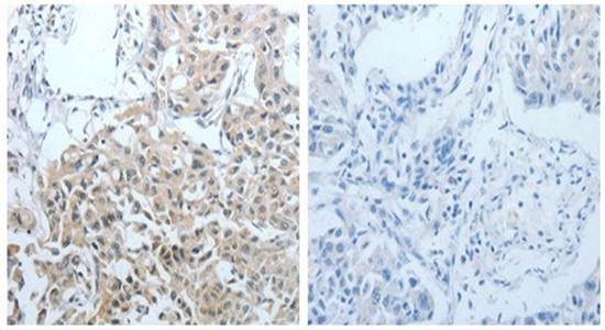 CEACAM1 Antibody