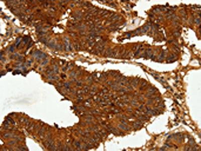 CEACAM21 antibody