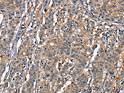 CEACAM3 antibody