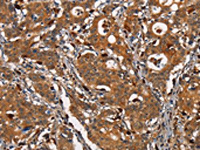 CEACAM3 Antibody