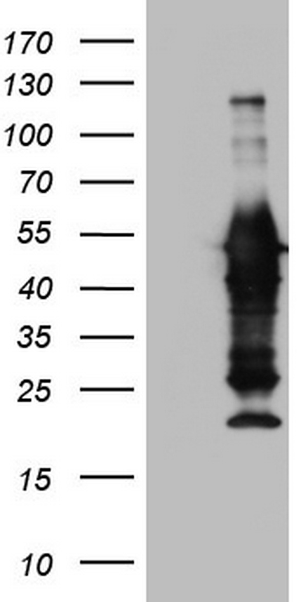 CEACAM5 Antibody
