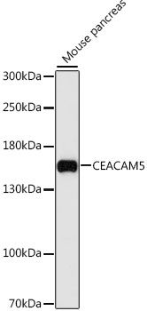 CEACAM5 antibody