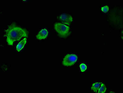 CEACAM5 antibody