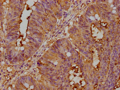 CEACAM5 antibody