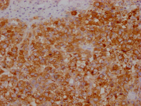 CEACAM5 antibody