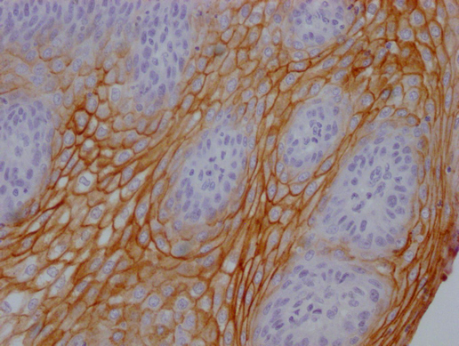 CEACAM5 antibody