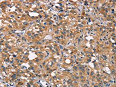 CEACAM6 Antibody