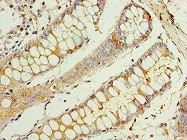 CEACAM8 Antibody
