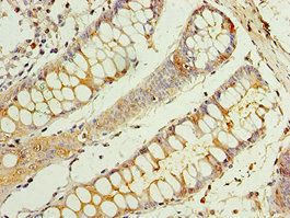 CEACAM8 antibody