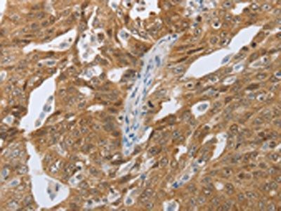 CEBPA Antibody
