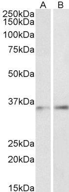 Goat anti-CEBPB (aa68-81) Antibody
