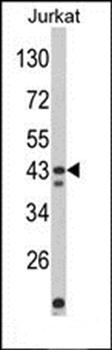 CECR5 antibody