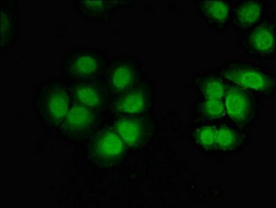 CELF2 antibody