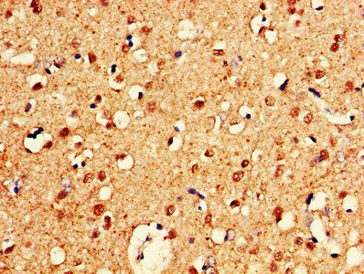 CELF2 Antibody