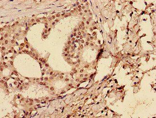 Cellular tumor p53 antibody