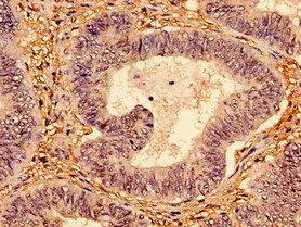 TP53 Antibody
