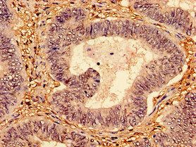 Cellular tumor p53 antibody