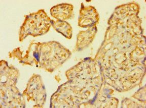 Cellular tumor p53 antibody