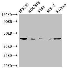 Cellular tumor p53 antibody