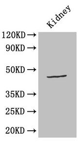 Cellular tumor p53 antibody