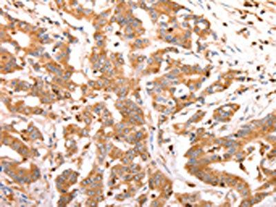 CELSR2 Antibody