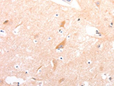 CELSR2 Antibody