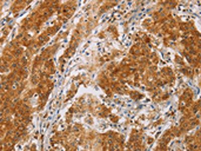 CENPE Antibody