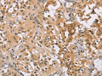 CENPF Antibody
