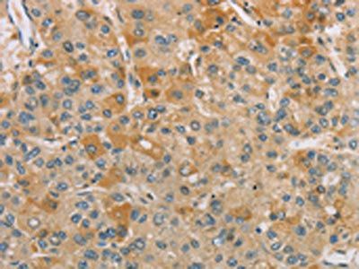 CENPF Antibody