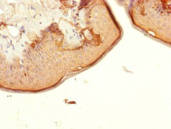 CENPK Antibody
