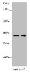 CENPK Antibody