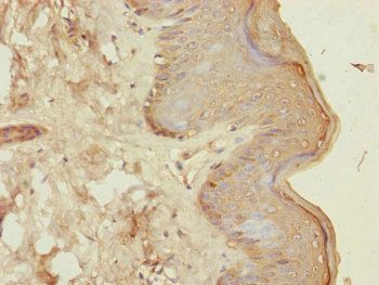 CENPK Antibody