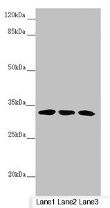 CENPK Antibody